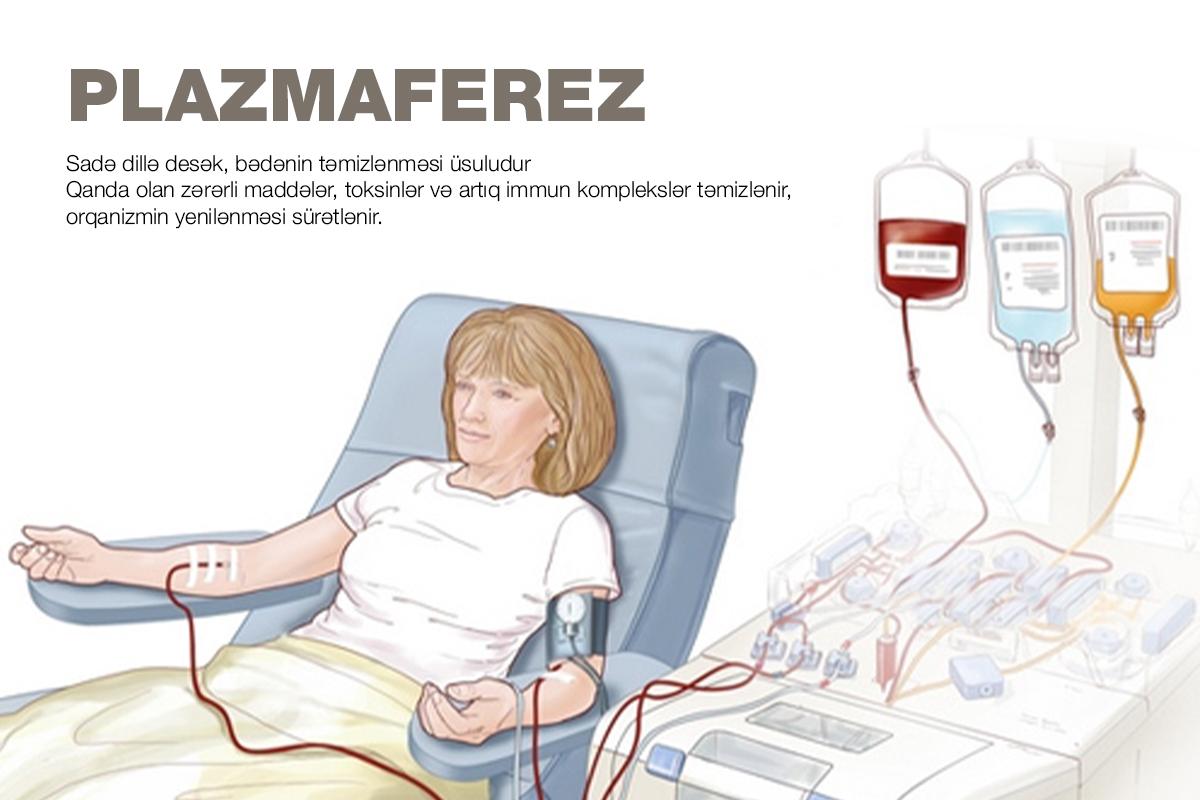 PLAZMAFEREZ